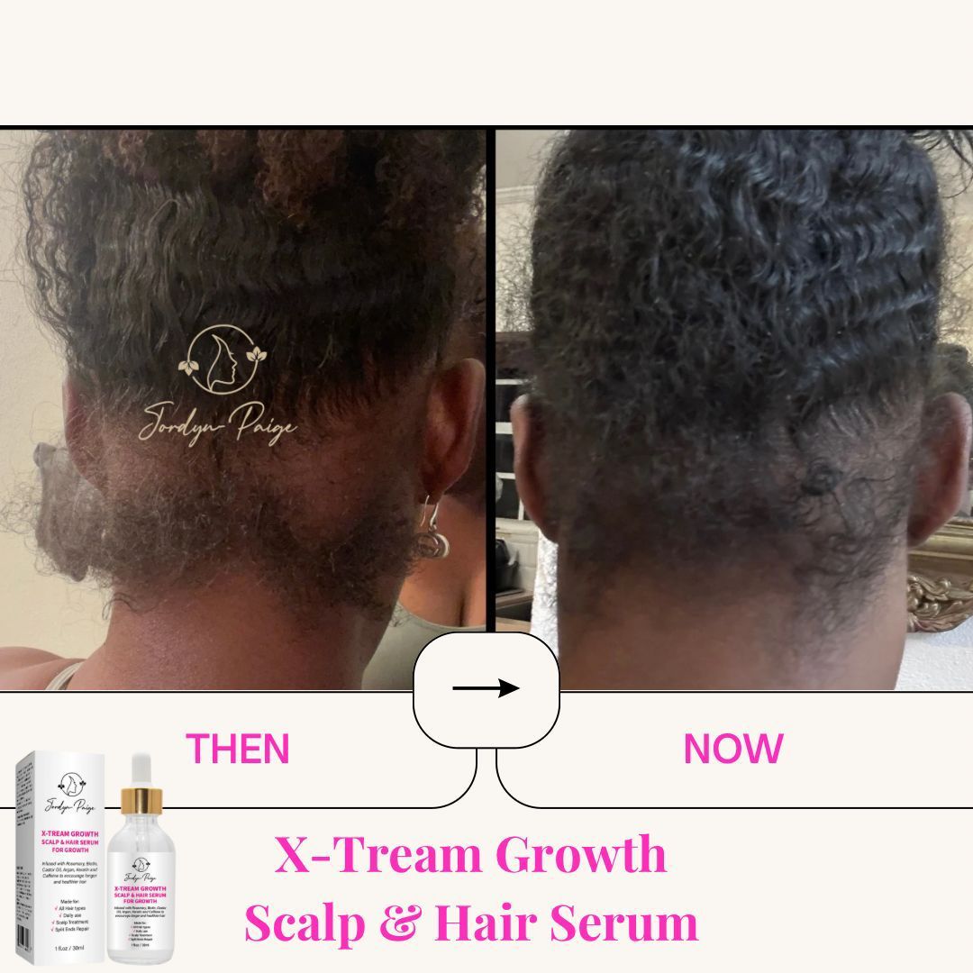 Scalp & Hair Serum for Growth