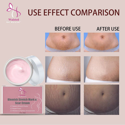 Blemish Stretch Mark & Scar Cream