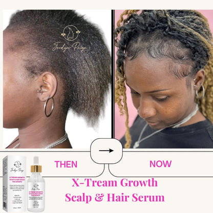 Scalp & Hair Serum for Growth