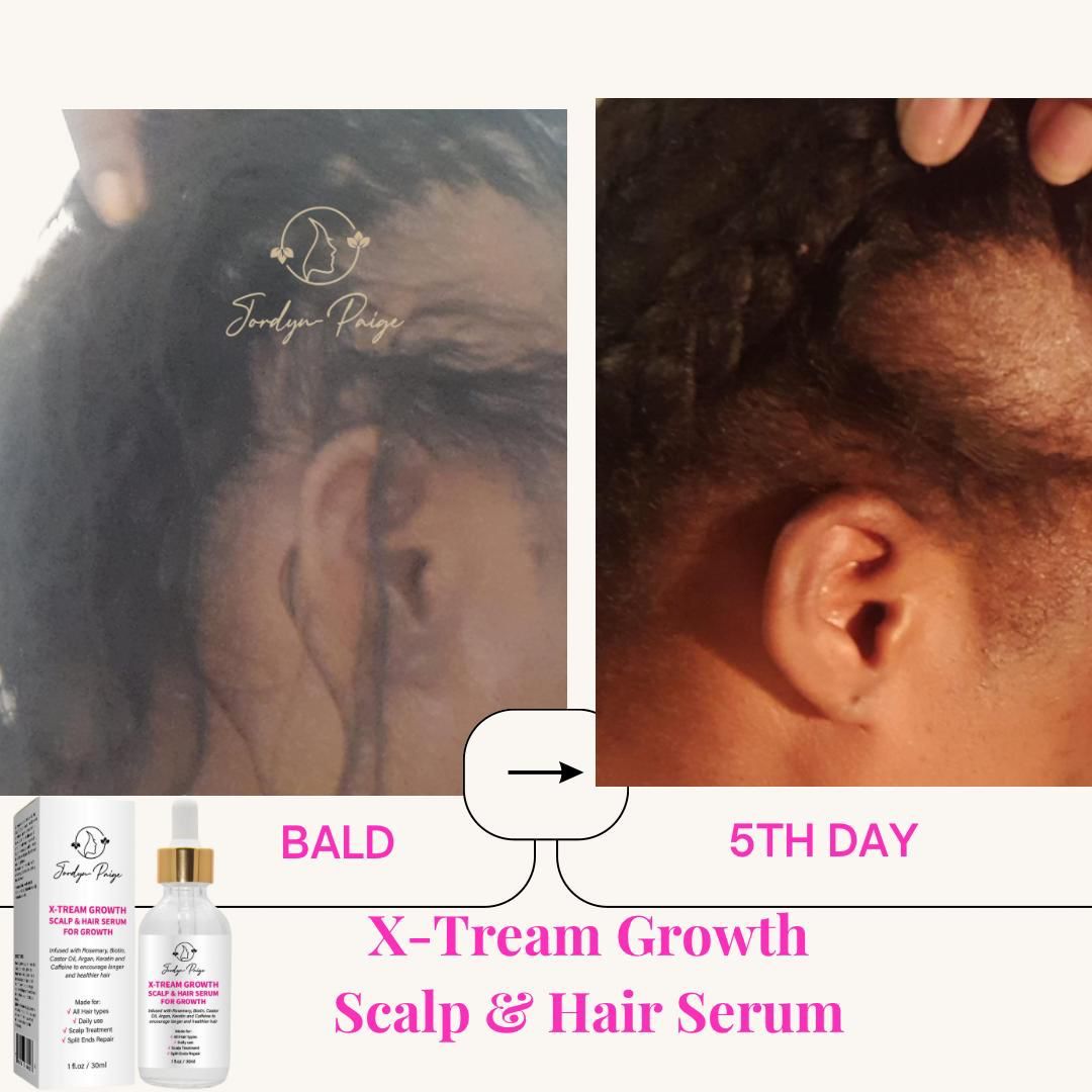Scalp & Hair Serum for Growth