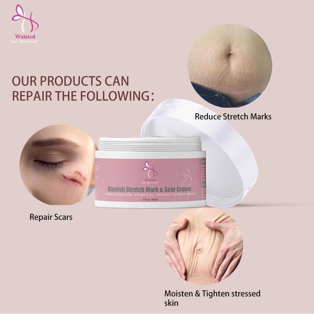 Blemish Stretch Mark & Scar Cream